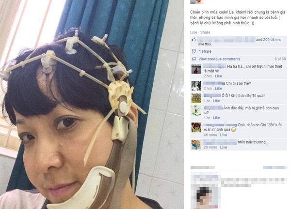 Thảo Vân phủ nhận tin đồn bị teo não