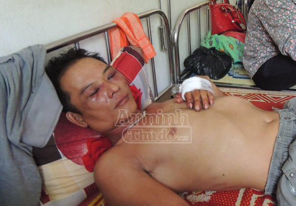 Hà Tĩnh: Nhóm côn đồ chặn đầu xe, đánh tài xế nhập viện
