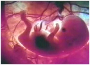 Hành trình loại bỏ PCB tại VN- Kỳ 2 Phơi nhiễm & hệ lụy