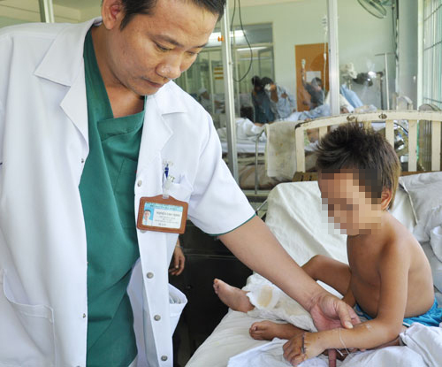 Say rượu, chém đứt lìa bàn tay cháu họ 7 tuổi