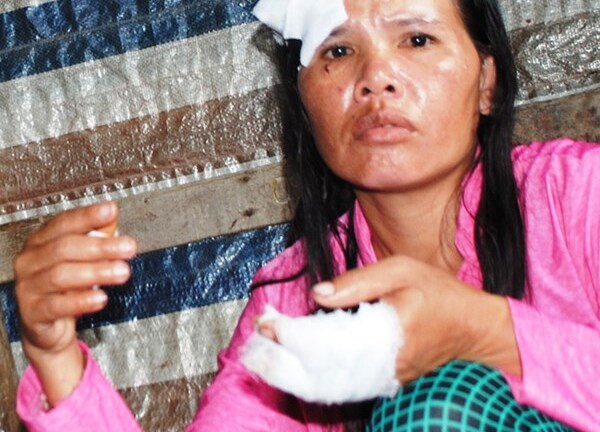 Đang ngồi xem ti vi, đôi vợ chồng bị chém tới tấp