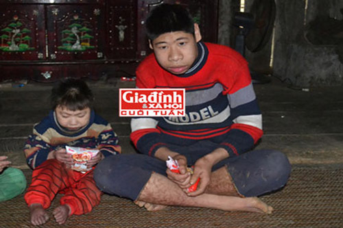 Đau lòng những đứa trẻ sinh ra đều mang hình hài của… khỉ