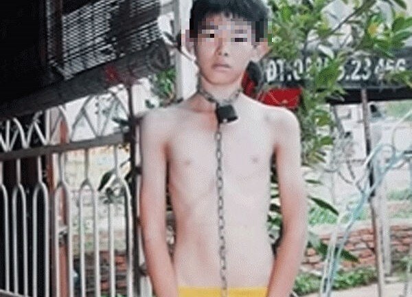 Gia Lai: Cha hành hạ, xích con ruột đánh đập dã man