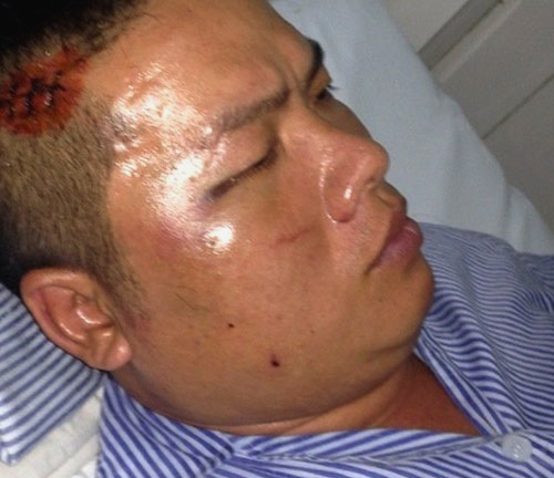 Đại ca giang hồ đất Cảng bị đàn em “xóa số“