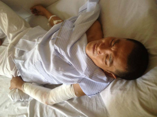 Côn đồ rút súng, hành hung bà bầu, chém gần lìa tay chồng