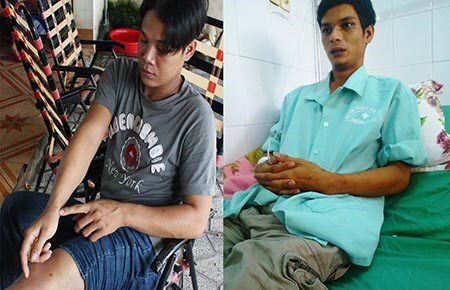 Nghi vấn công an đánh, ép dân nhận tội