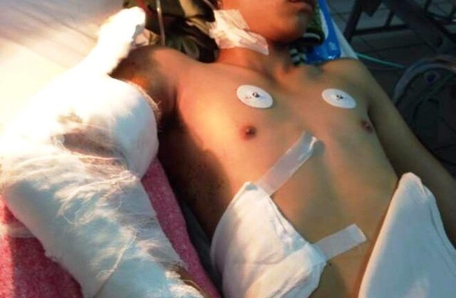 Thanh niên bị chém mất cánh tay la hét ở bệnh viện