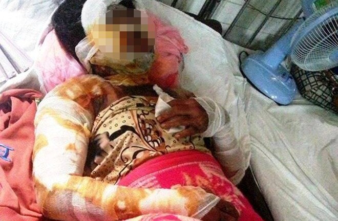 Thai phụ bị thiêu sống và nỗi buồn các cuộc tình chóng vánh