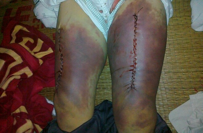 Truy tố hai cán bộ điều tra đánh chết nghi phạm