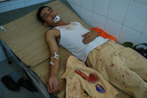 Lăn xả cứu người dân, CSGT bị côn đồ chém trọng thương