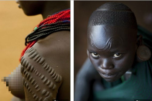 Những phương pháp làm đẹp 'kinh khủng' trên thế giới