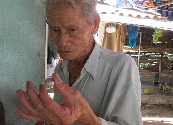 Chuyện lạ về lão nông trị độc bằng “viên ngọc độc“