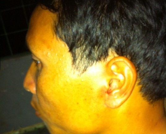 Tài xế tố bị cảnh sát giao thông hành hung