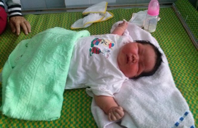 Bé sơ sinh 6,5kg ra đời suôn sẻ