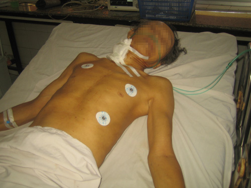 Con dùng dao thái thịt cắt cổ cha đang nằm ngủ