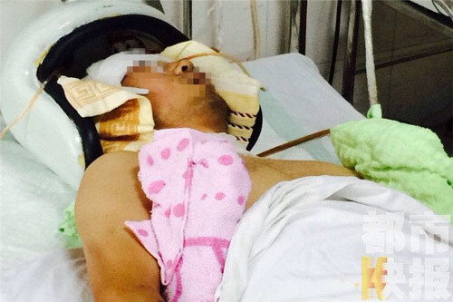 Đi mát xa đánh trọng thương chủ