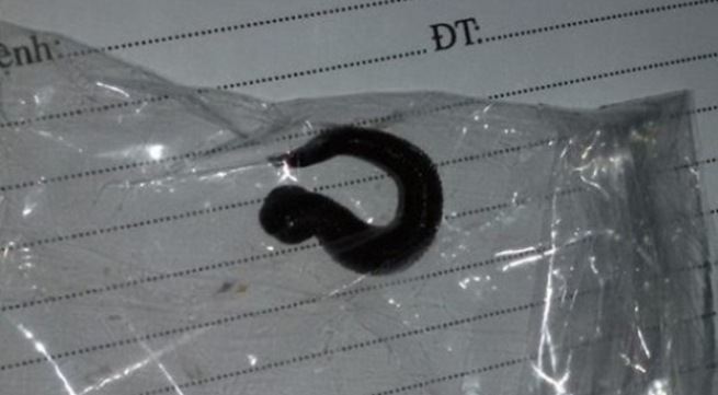 Hãi hùng đỉa dài 5cm 