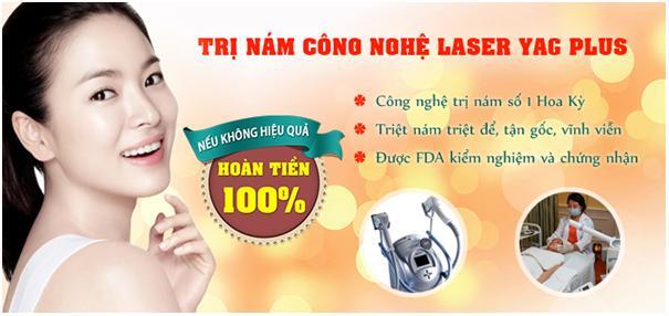 Chuyện “trị nám tận gốc” – Đâu thực sự là giải pháp vàng?