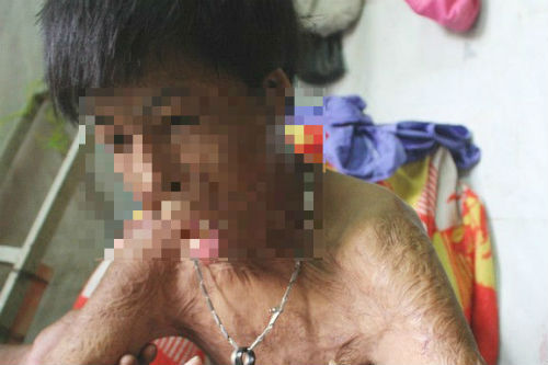 Cuộc sống khổ cực của chàng trai