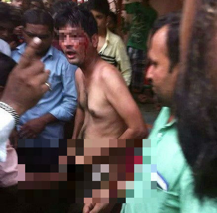 Người đàn ông bị cắt