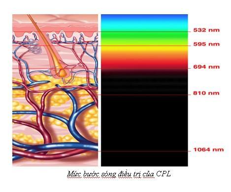 Triệt lông với Xlaser – những “điểm cộng” không phải ai cũng biết
