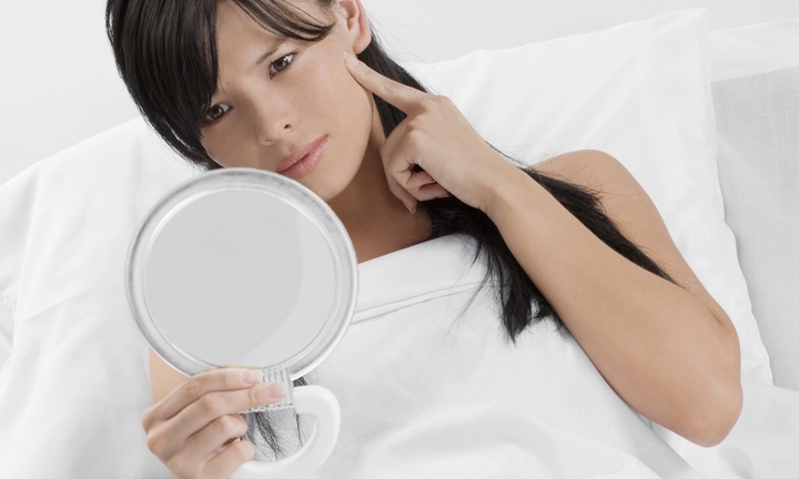 Tuổi dậy thì: “Bí kíp” sạch mụn trứng cá 