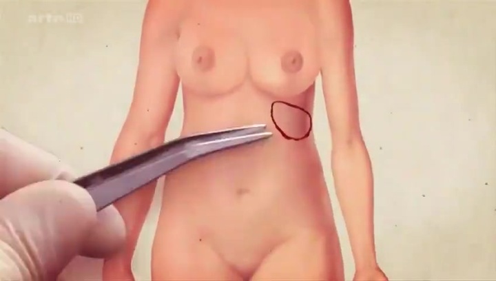 Clip: Mô phỏng hậu quả khôn lường khi phẫu thuật thẩm mỹ