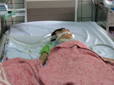 Ăn sắn cao sản nướng, bé trai bị hôn mê