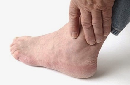 Yếu tố làm khởi phát bệnh vẩy nến