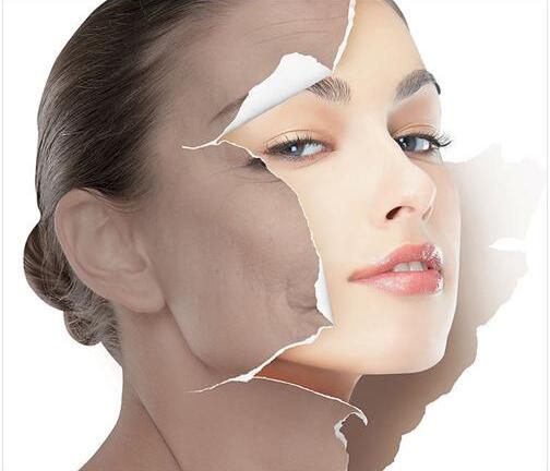 Laser Yag Plus xứng danh công nghệ trị nám hiệu quả nhất hiện nay