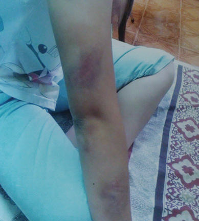 Thiếu nữ 18 tuổi bị cha mẹ nhốt, đánh vì... yêu thầy