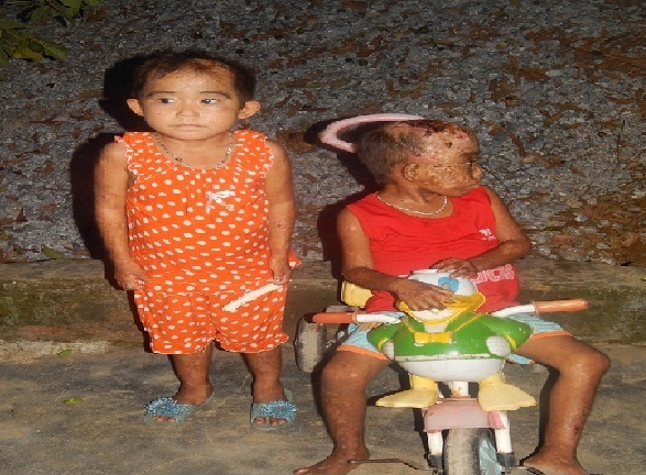 Nước mắt tủi hờn của cậu bé 7 tuổi mang căn bệnh quái ác