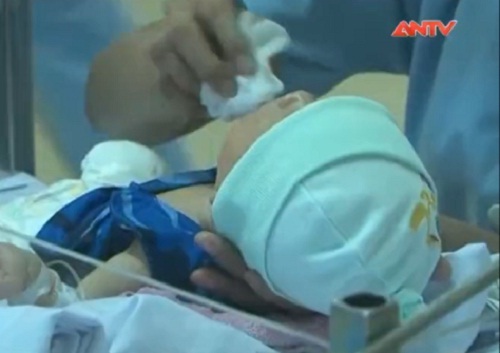 Clip: Cháu bé sơ sinh bị văng ra khỏi bụng mẹ đã xuất viện