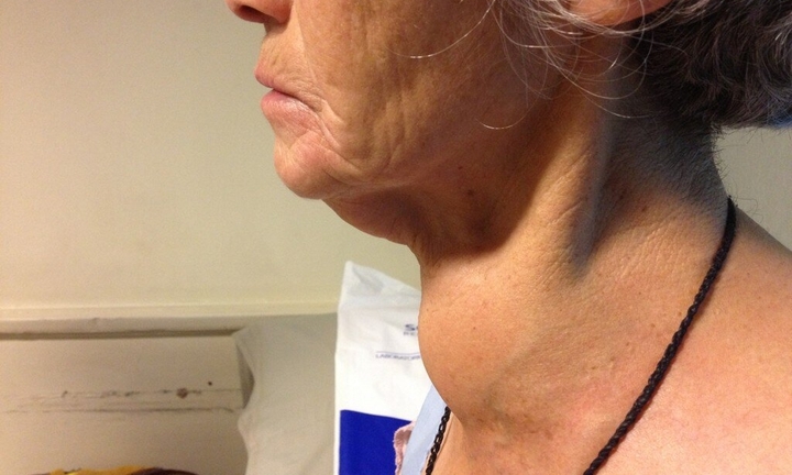 Hỏi và đáp về bệnh lý tuyến giáp