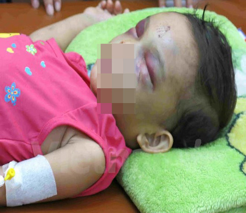 Bạo hành dã man trẻ em: Cần truy tố về tội Giết người?