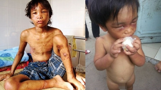 Video: Những vụ bạo hành trẻ em tàn độc gây chấn động Việt Nam