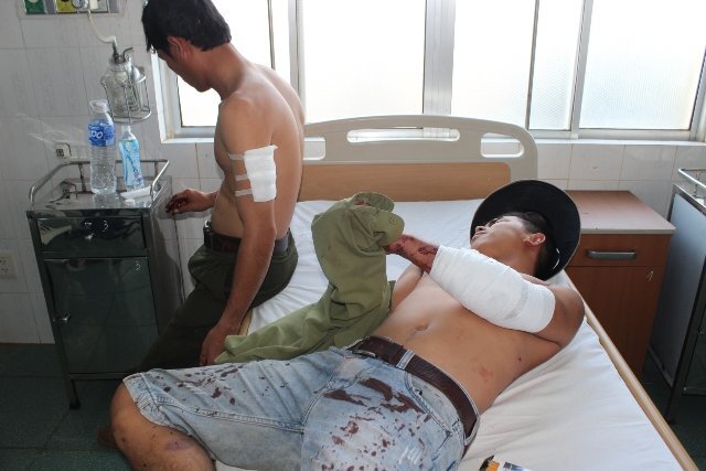 Đi kiểm tra rừng, ba nhân viên bảo vệ bị chém trọng thương