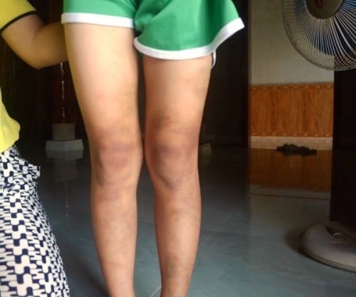 Bố đánh con gái dã man vì sang nhà mẹ chơi không xin phép