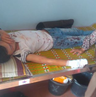 Bị côn đồ vào nhà chém trọng thương vì nghi nói xấu trên Facebook