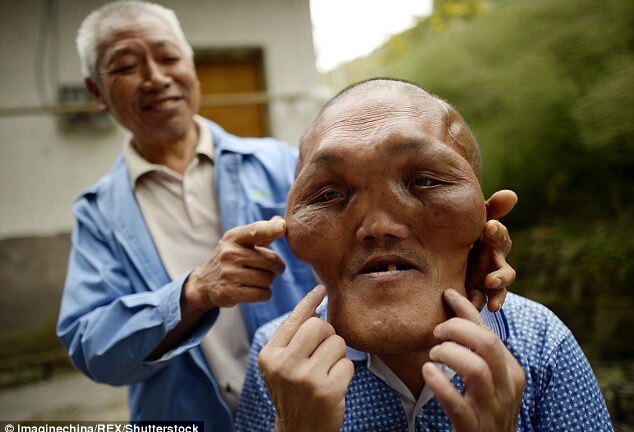 Chàng trai có khuôn mặt kỳ dị bị nhầm là người ngoài hành tinh