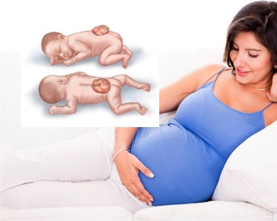 Các dị tật thai nhi bẩm sinh thường gặp