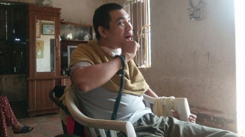 Cú ngã bất ngờ và những điểm bất thường trong hồ sơ một vụ tai nạn giao thông