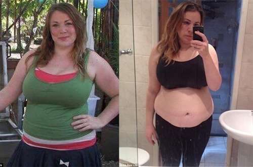 Người phụ nữ 1 tạ giảm cân ngoạn mục nhờ... suy nghĩ