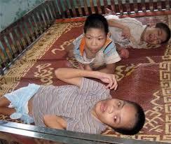 Cán bộ xã ăn chặn gần 300 triệu tiền hỗ trợ người khuyết tật