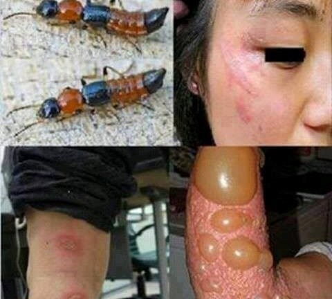 Cách đuổi kiến ba khoang và xử trí vết thương do kiến ba khoang đốt hiệu quả