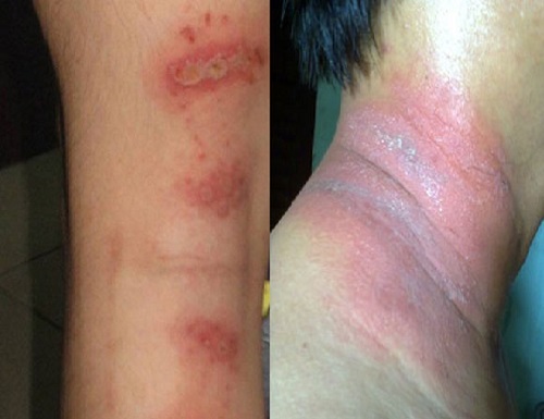 Cư dân ven đô cơ khổ vì kiến ba khoang tấn công