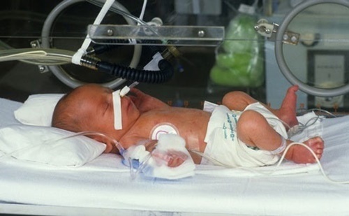 Những nguyên nhân cơ bản khiến bà bầu sinh non trước tuần 37