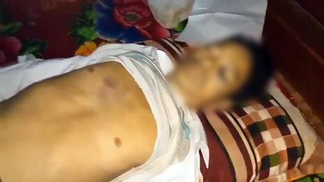 Triệu tập công an xã Lãng Công để làm rõ vụ tử vong bất thường