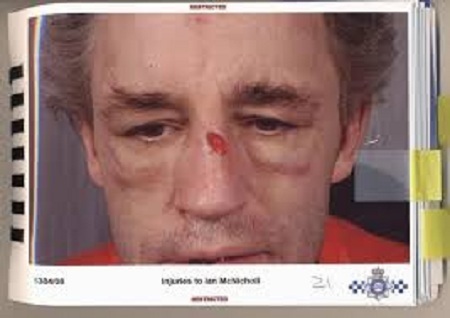 Người đàn ông bị bạn gái đánh đập chỉ vì từ chối quan hệ