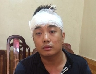 Hà Nội: Tên trộm dùng búa đinh đập vào đầu chủ nhà